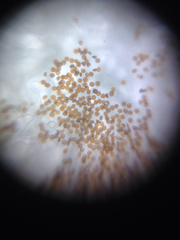 Puccinia hydrocotyles