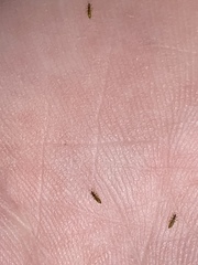 Frankliniella