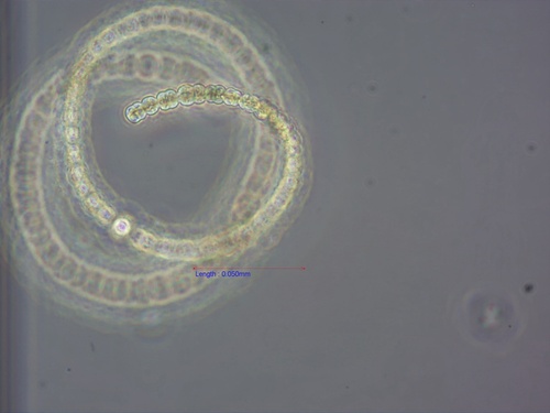Dolichospermum circinale, 2026-05-13