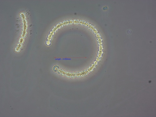 Dolichospermum circinale, 2026-05-13
