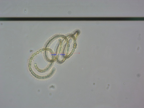 Dolichospermum circinale, 2026-05-13