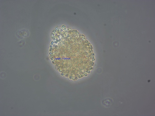 Polycystis, 2026-05-13