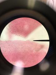 Sphaerococcus coronopifolius