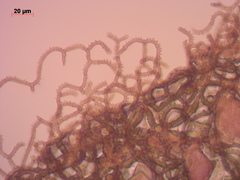Arcyria stipata