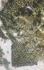 Preussia fleischhakii