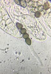 Preussia fleischhakii