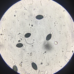Podospora pleiospora