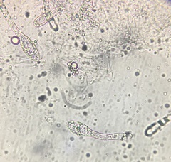 Podospora pleiospora