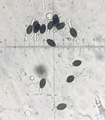 Podospora pleiospora