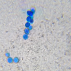 Saccharomyces cerevisiae
