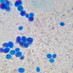 Saccharomyces cerevisiae
