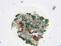 Mycoblastus sanguinarius