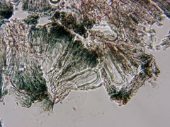 Mycoblastus sanguinarius