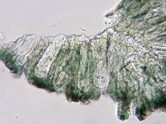 Mycoblastus sanguinarius