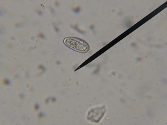 Mycoblastus sanguinarius