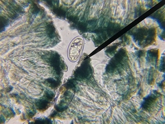 Mycoblastus sanguinarius