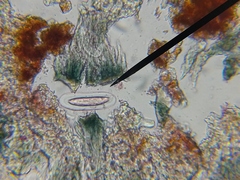 Mycoblastus sanguinarius