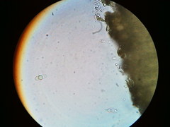 Trapeliopsis viridescens