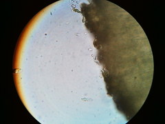 Trapeliopsis viridescens