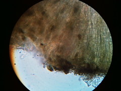 Trapeliopsis viridescens