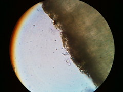 Trapeliopsis viridescens