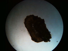 Trapeliopsis viridescens