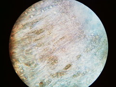 Trapeliopsis viridescens