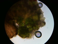 Trapeliopsis viridescens