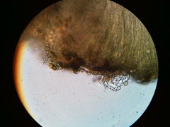 Trapeliopsis viridescens