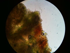 Trapeliopsis viridescens