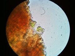 Trapeliopsis viridescens