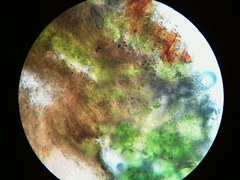 Trapeliopsis viridescens