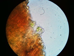 Trapeliopsis viridescens