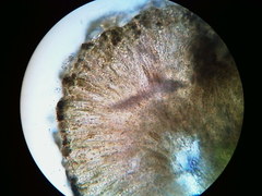 Trapeliopsis viridescens