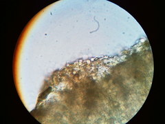 Trapeliopsis viridescens