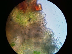 Trapeliopsis viridescens