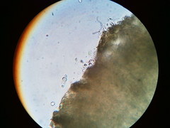 Trapeliopsis viridescens