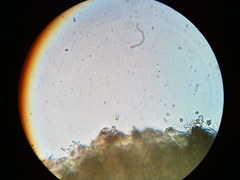 Trapeliopsis viridescens