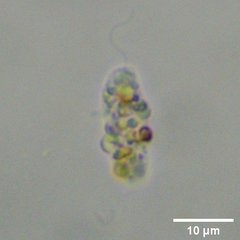 Protozoa