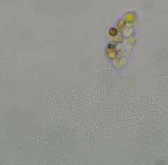 Protozoa