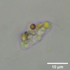 Protozoa