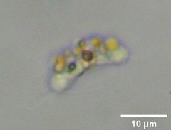 Protozoa