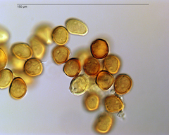 Uromyces polygoni-avicularis