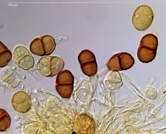 Puccinia otagensis