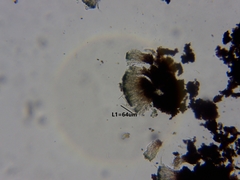 Bacidia schweinitzii