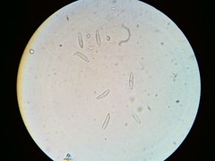 Arachnopeziza trabinelloides