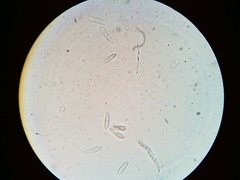 Arachnopeziza trabinelloides