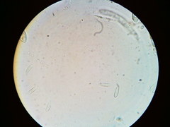 Arachnopeziza trabinelloides