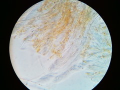 Arachnopeziza trabinelloides