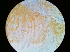 Arachnopeziza trabinelloides